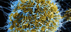 tecnologia-saude-ebola-telemedicina
